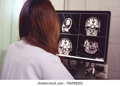 MRI Brain Of Dementia Patient