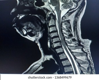 22 C7 spinal nerve Images, Stock Photos & Vectors | Shutterstock