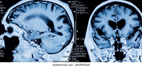 MRI Head Scan MRI Head Scan - Powered by Shutterstock