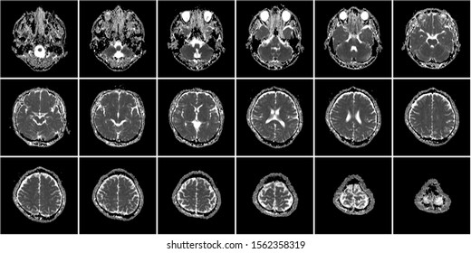 Mri Of Head Thumbnail Data