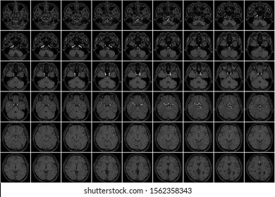 Mri Of Head Thumbnail Data