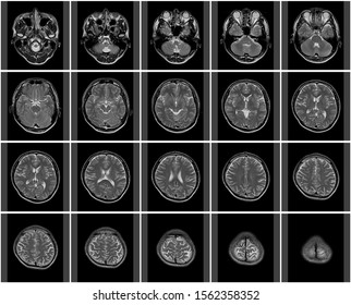 Mri Of Head Thumbnail Data