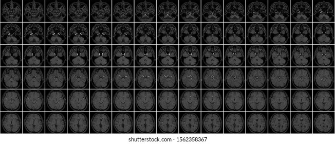 Mri Of Head Thumbnail Data