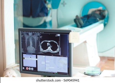 MRI Machine And Screens With Doctor And Nurse