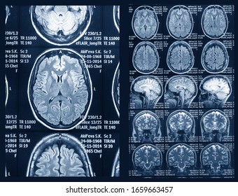 MRI scan of the brain for diagnosis. Medical examination for health prevention. - Shutterstock ID 1659663457