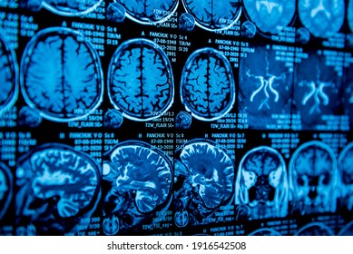 MRI Scan Of The Brain. Magnetic Resonance Imaging Scan