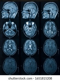 11,348 Brain scan mri Images, Stock Photos & Vectors | Shutterstock