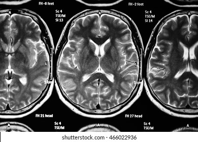 Mri Scan Film