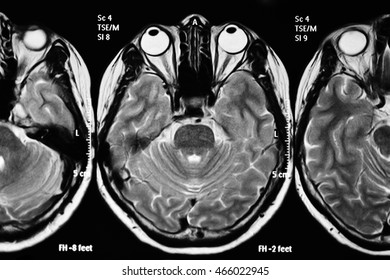 Mri Scan Film