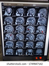 MRI Scan Sheet Of A Healthy Brain Of A Human In Saggital Section 