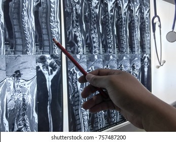 MRI Of The Spine In Different Projections