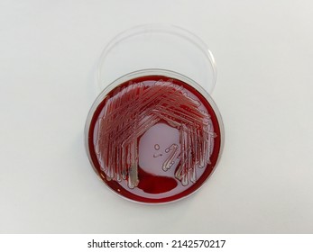 MRSA, Staphylococcus aureus: Gram-positive, to Gram-variable, nonmotile, Coccus,beta haemolysis, saprotrophic bacterium that belongs to the family Staphylococcus growth on blood agar.