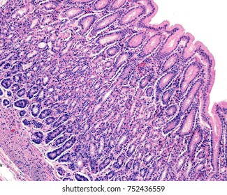 Mucosa Human Stomach Showing Surface Epithelium Stock Photo 752436559 ...