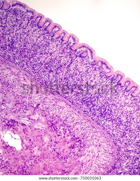 Mucosa Layer Shows Surface Mucous Epithelium Stock Photo 750031063 ...