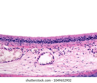 Mucosa Layer Of The Trachea Lined By A Pseudostratified Ciliated Columnar Epithelium (respiratory Epithelium). The Lamina Propria Show Large Blood Vessels. 