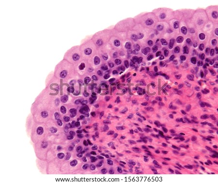 Mucosa of urinary bladder lined by transitional epithelium (urothelium) resting on a connective tissue lamina propria. The superficial layer shows large cells with big nuclei (one of them binucleated)