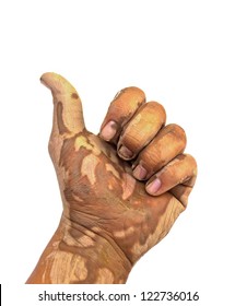 Muddy Hands On A White Background.