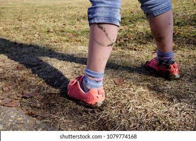                 Muddy Legs And Feet After A Spring Walk In Edmonton Alberta               