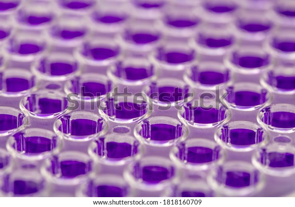Multi channel pipette loading\
biological samples in microplate for test in the laboratory /\
Multichannel pipette load samples in pcr microplate with 96\
wells.