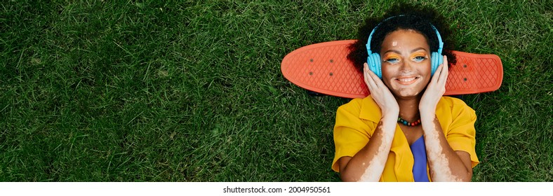 Multi-ethnic Woman With Vitiligo Wearing Blue Headphones Listens To Music Lying A Lawn Near Skateboard With A Happy Face. Green Grass With Empty Space For Text