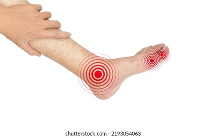 Multiple Foot Joints Inflammation. Concept And Idea Of Rheumatoid Arthritis, Polyarthritis, Gout, Toe Joint Swelling Or Arthralgia.