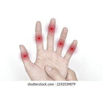 Multiple Joints Inflammation. Concept And Idea Of Rheumatic Arthritis, Polyarthritis, Hand Joint Swelling Or Arthralgia.