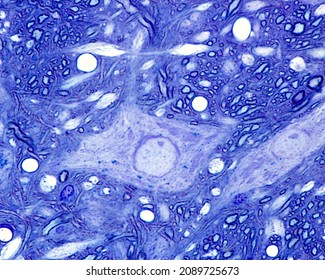 Multipolar Neuron Surrounded By Myelinated Fibers. The Neuronal Cell Body Shows Large Nissl Bodies. 0.5 Micrometre Thick Section Of Plastic Embedded Material. Toluidine Blue