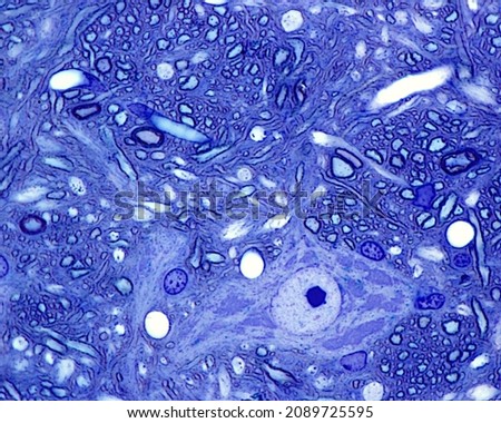 Multipolar neuron surrounded by myelinated fibers. The neuronal cell body shows large Nissl bodies and a big nucleolus. 0.5 micrometre thick section of plastic embedded material. Toluidine blue
