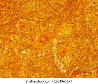 Multipolar Neurons Of The Anterior Horn Of The Spinal Cord Stained With The Cajal's Silver Nitrate Method.