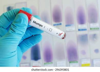 Mumps Virus Positive