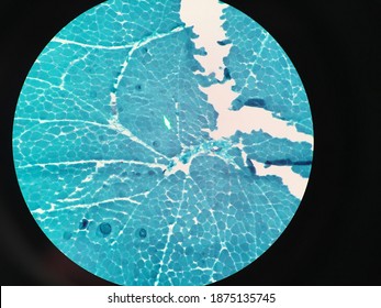 Muscle Biopsy Under Gomori Trichrome Staining, Showing Normal Muscle Fiber.