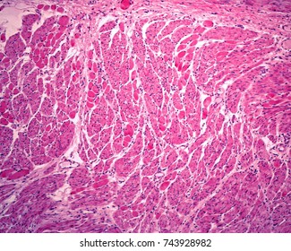 Muscle layer of the esophagus showing a mixture of smooth muscle fibers and striated muscle fibers (large reddish circles).