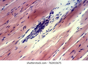 Muscle Spindle In Longitudinal Section, Located Between Normal Or Extrafusal Muscle Fibers. Two Types Of Fiber Are Distinguished In Its Interior: Nuclear Chain Fibers And Nuclear Bag Fibers.