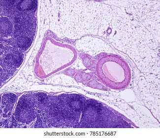 Vein Histology Images Stock Photos Vectors Shutterstock