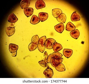 Mussel (Anodonta Sp.) Glochidia - Permanent Slide Plate Under High Magnification