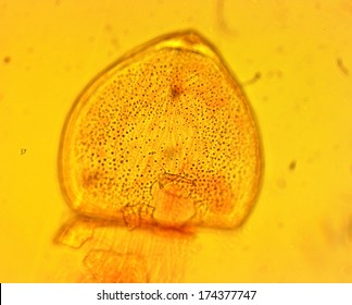 Mussel (Anodonta Sp.) Glochidia - Permanent Slide Plate Under High Magnification