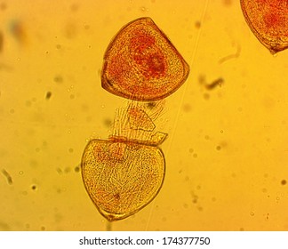 Mussel (Anodonta Sp.) Glochidia - Permanent Slide Plate Under High Magnification