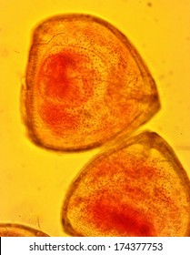 Mussel (Anodonta Sp.) Glochidia - Permanent Slide Plate Under High Magnification