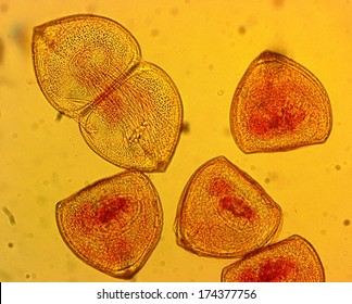 Mussel (Anodonta Sp.) Glochidia - Permanent Slide Plate Under High Magnification