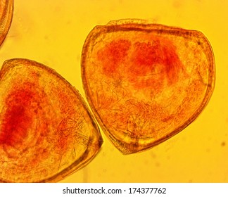 Mussel (Anodonta Sp.) Glochidia - Permanent Slide Plate Under High Magnification