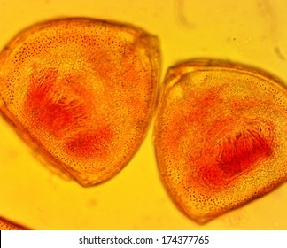 Mussel (Anodonta Sp.) Glochidia - Permanent Slide Plate Under High Magnification