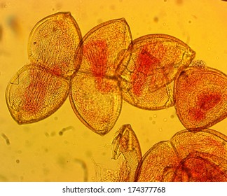 Mussel (Anodonta Sp.) Glochidia - Permanent Slide Plate Under High Magnification