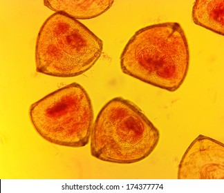 Mussel (Anodonta Sp.) Glochidia - Permanent Slide Plate Under High Magnification