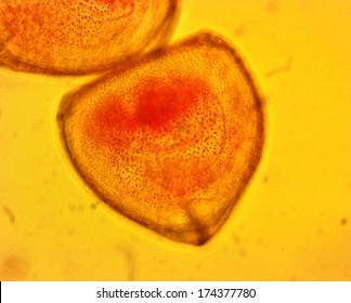 Mussel (Anodonta Sp.) Glochidia - Permanent Slide Plate Under High Magnification