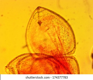 Mussel (Anodonta Sp.) Glochidia - Permanent Slide Plate Under High Magnification