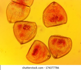 Mussel (Anodonta Sp.) Glochidia - Permanent Slide Plate Under High Magnification