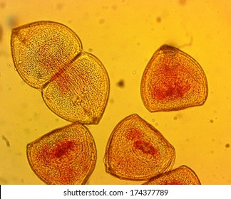 Mussel (Anodonta Sp.) Glochidia - Permanent Slide Plate Under High Magnification