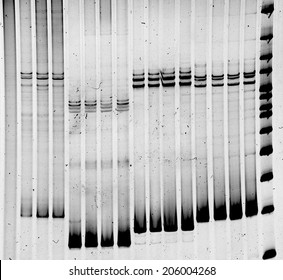 Mutation Analysis By Gel Electrophoresis