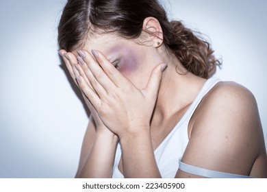 Mutilated Women Cover Her Bruised Face With Shame