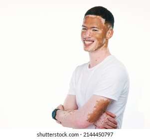 My skin doesnt define me. Portrait shot of a handsome young man with vitiligo posing with his arms folded on a white background. - Shutterstock ID 2144450797